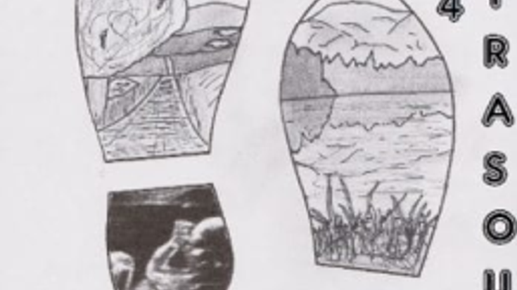 Pound The Ground For Ultrasound cover
